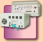 Vista Posterior UPS Advanced